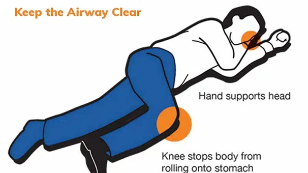 Diagram showing how to place someone in the recovery position to keep the airway clear